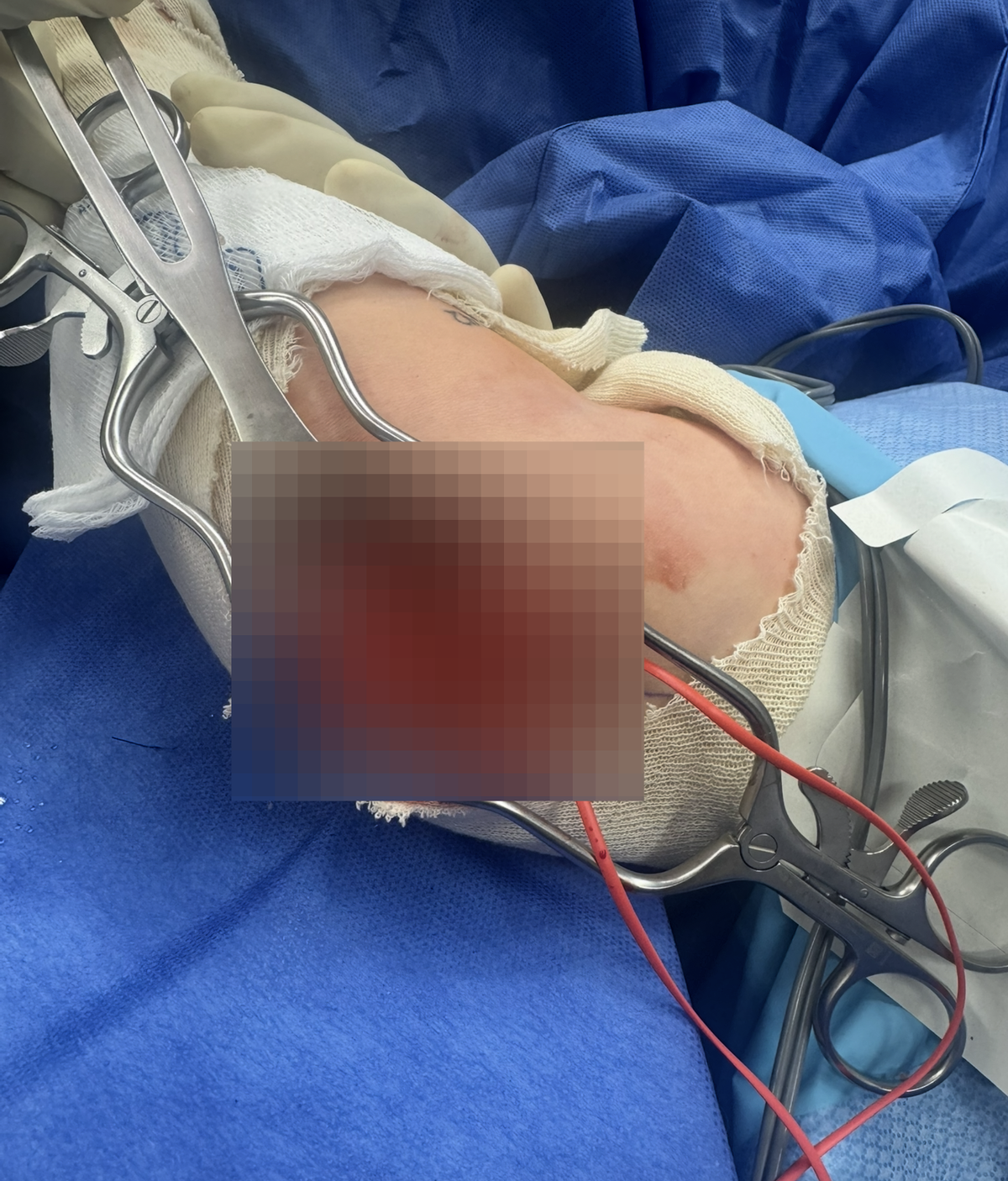 Justice on Hold: DUI Victim Left Disabled While County Official Awaits Slap on the Wrist